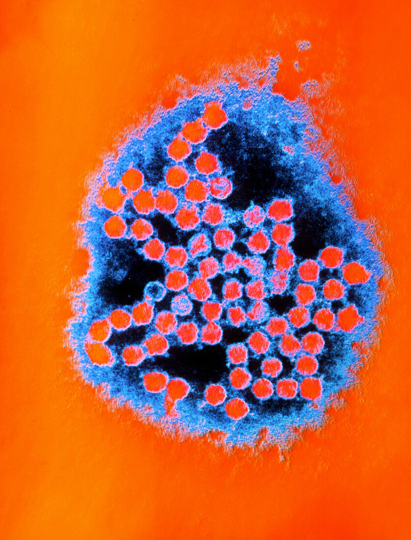 Coloured TEM of rhinoviruses,cause of common cold