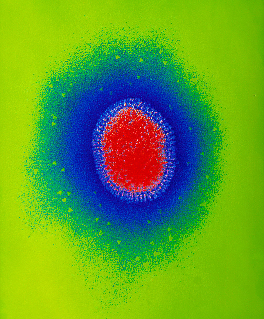 Coloured TEM of a single influenza virus