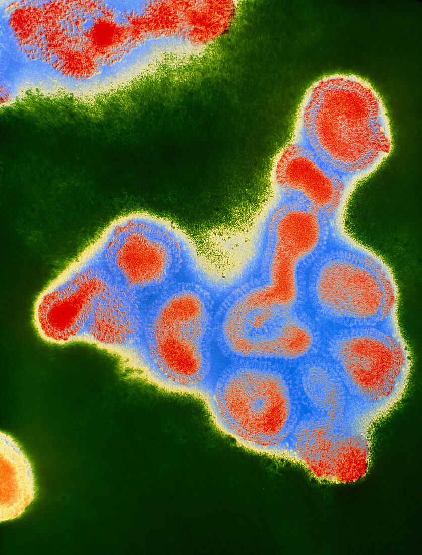 Colour TEM of a cluster of influenza viruses