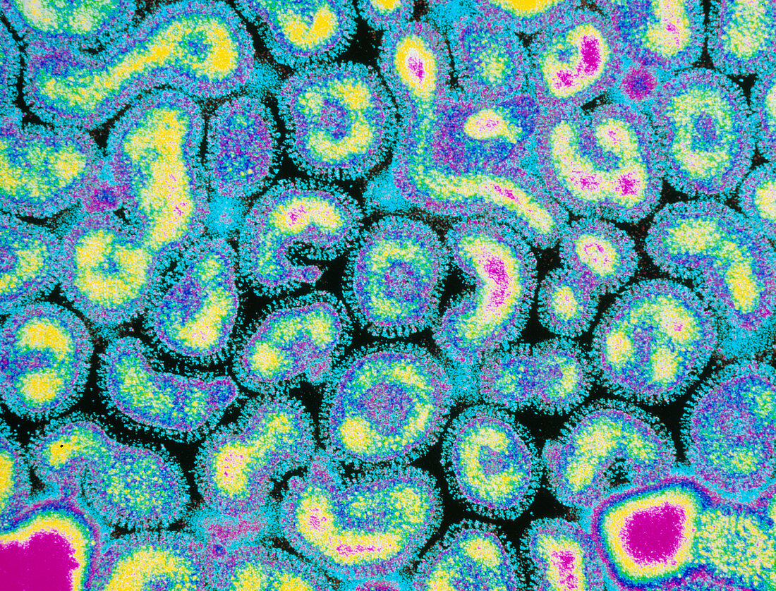 Coloured TEM of a group of influenza (flu) viruses