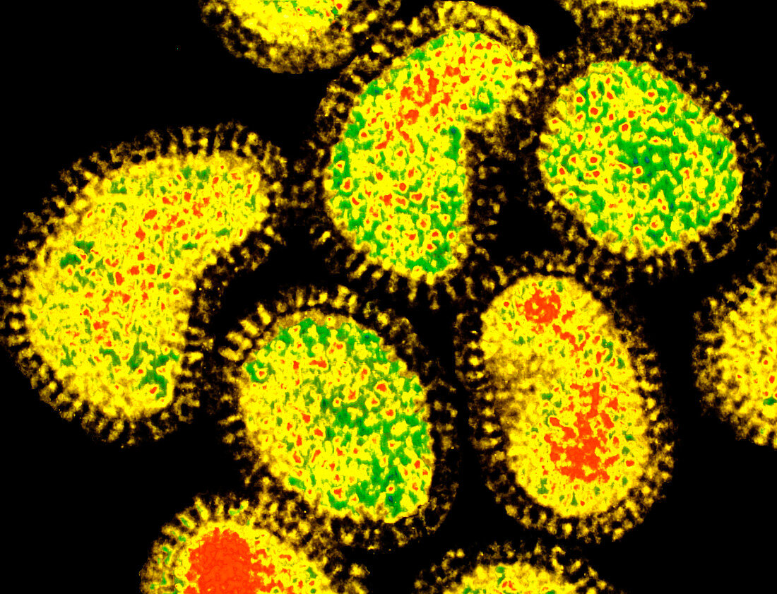 Coloured TEM of a cluster of influenza viruses