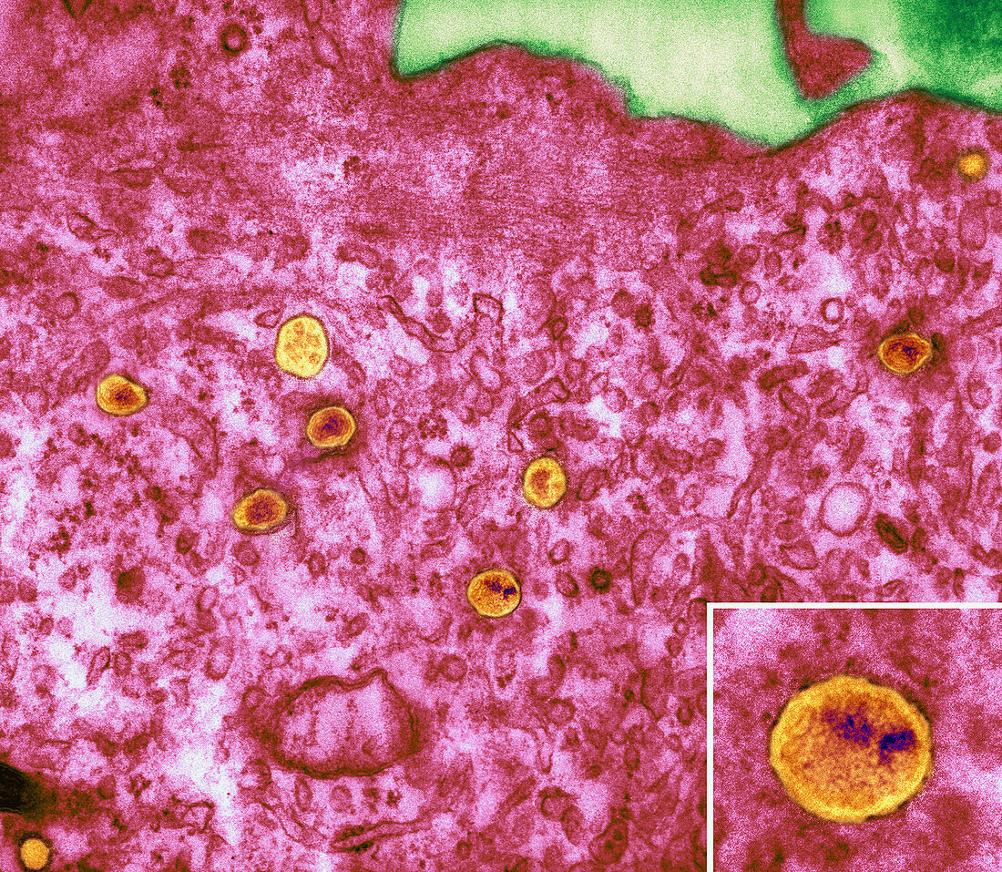 HIV particles in infected cell,TEM