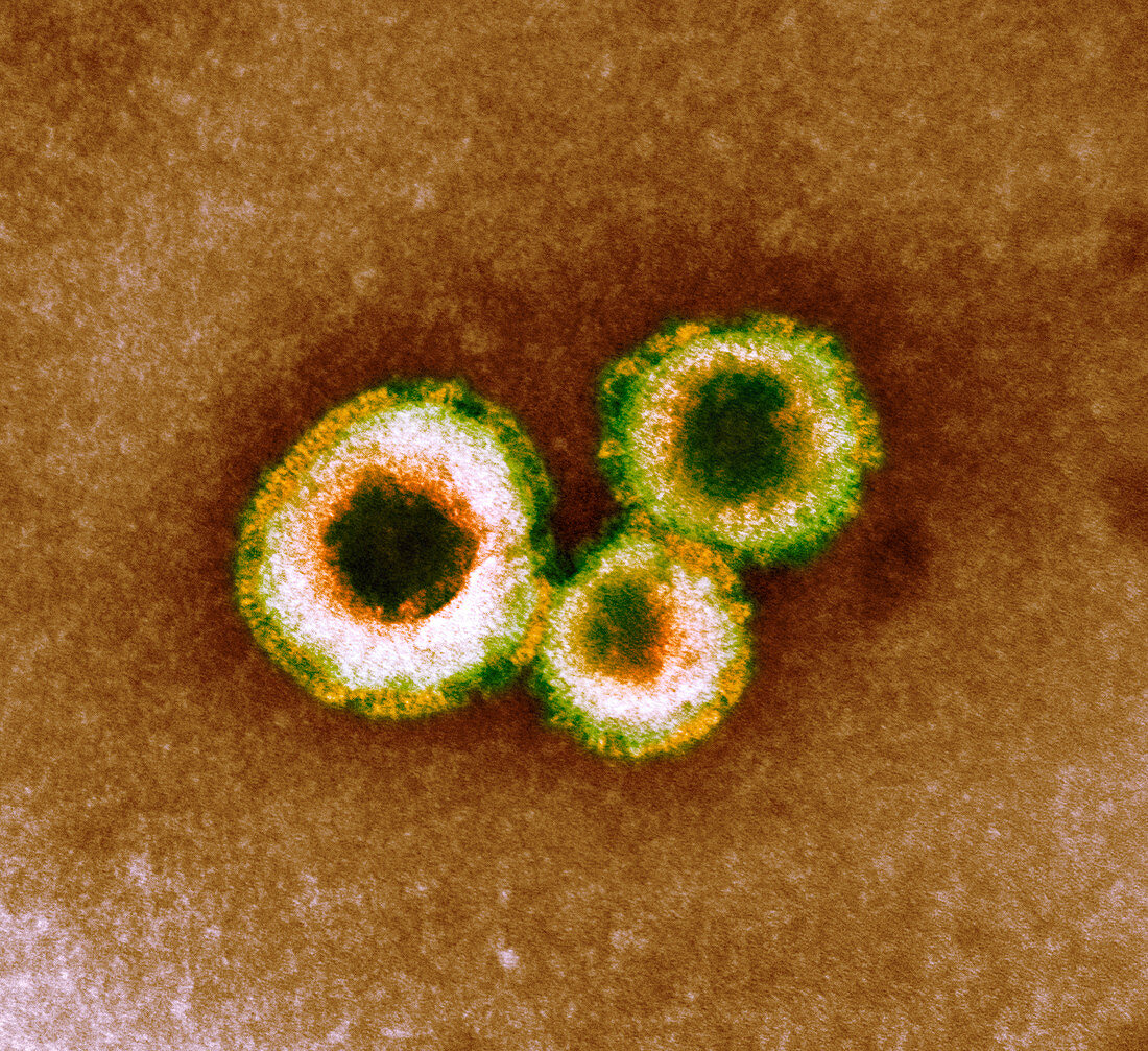 Human metapneumovirus particles,TEM