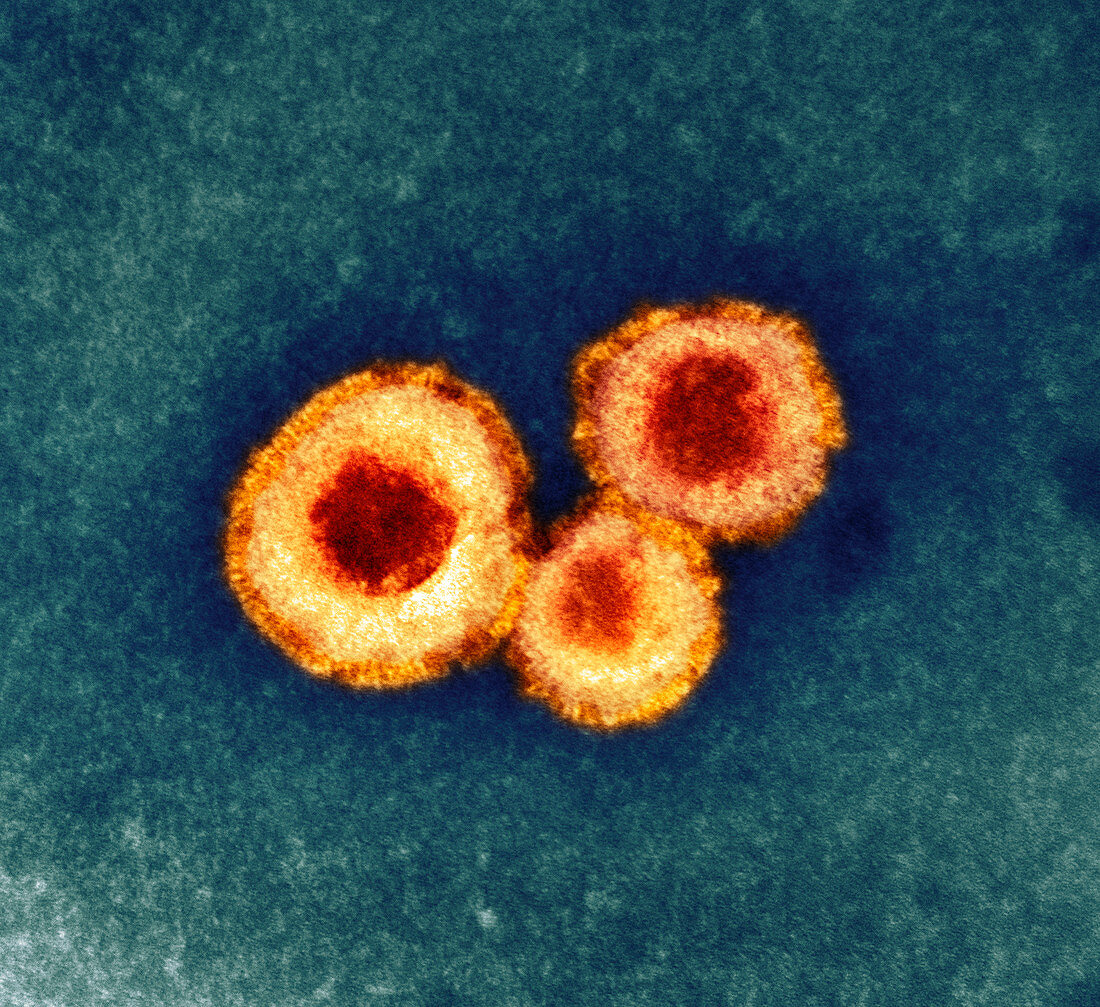 Human metapneumovirus particles,TEM