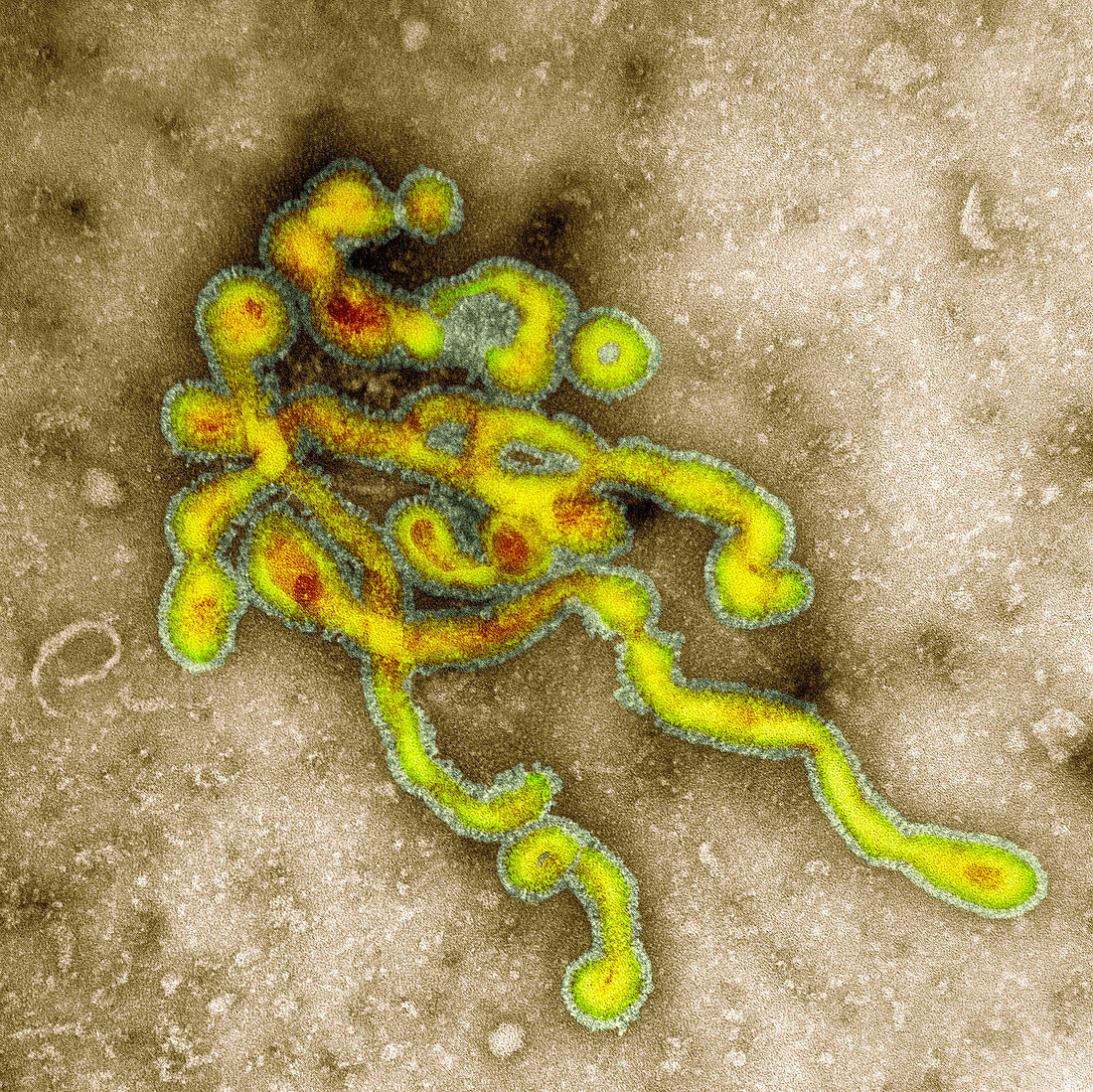 Influenzavirus C,TEM