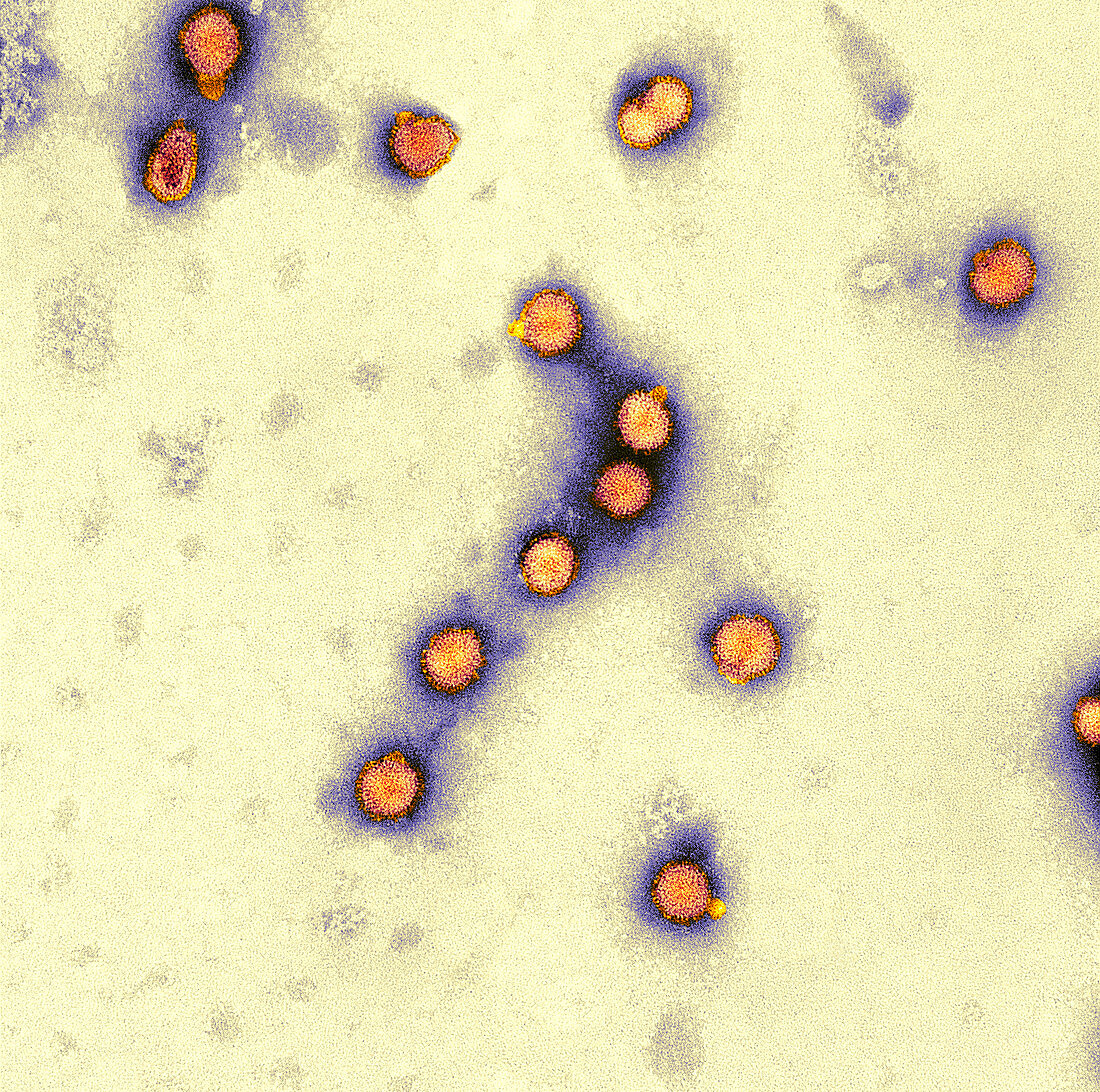 Avian influenza virus particles,TEM