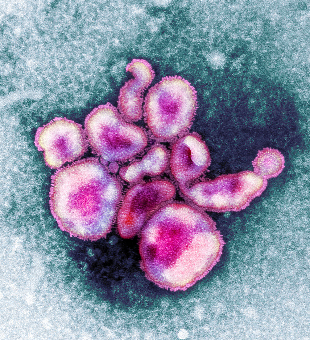 Avian influenza virus particles,TEM