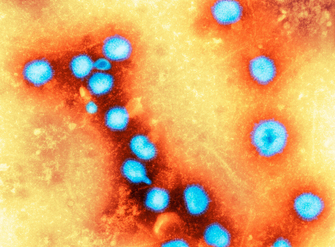Avian influenza virus particles,TEM