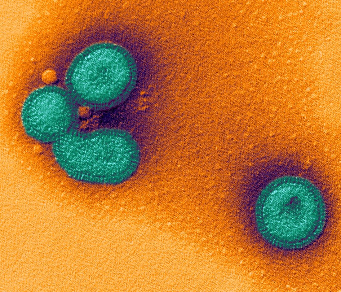 Influenzavirus B,TEM