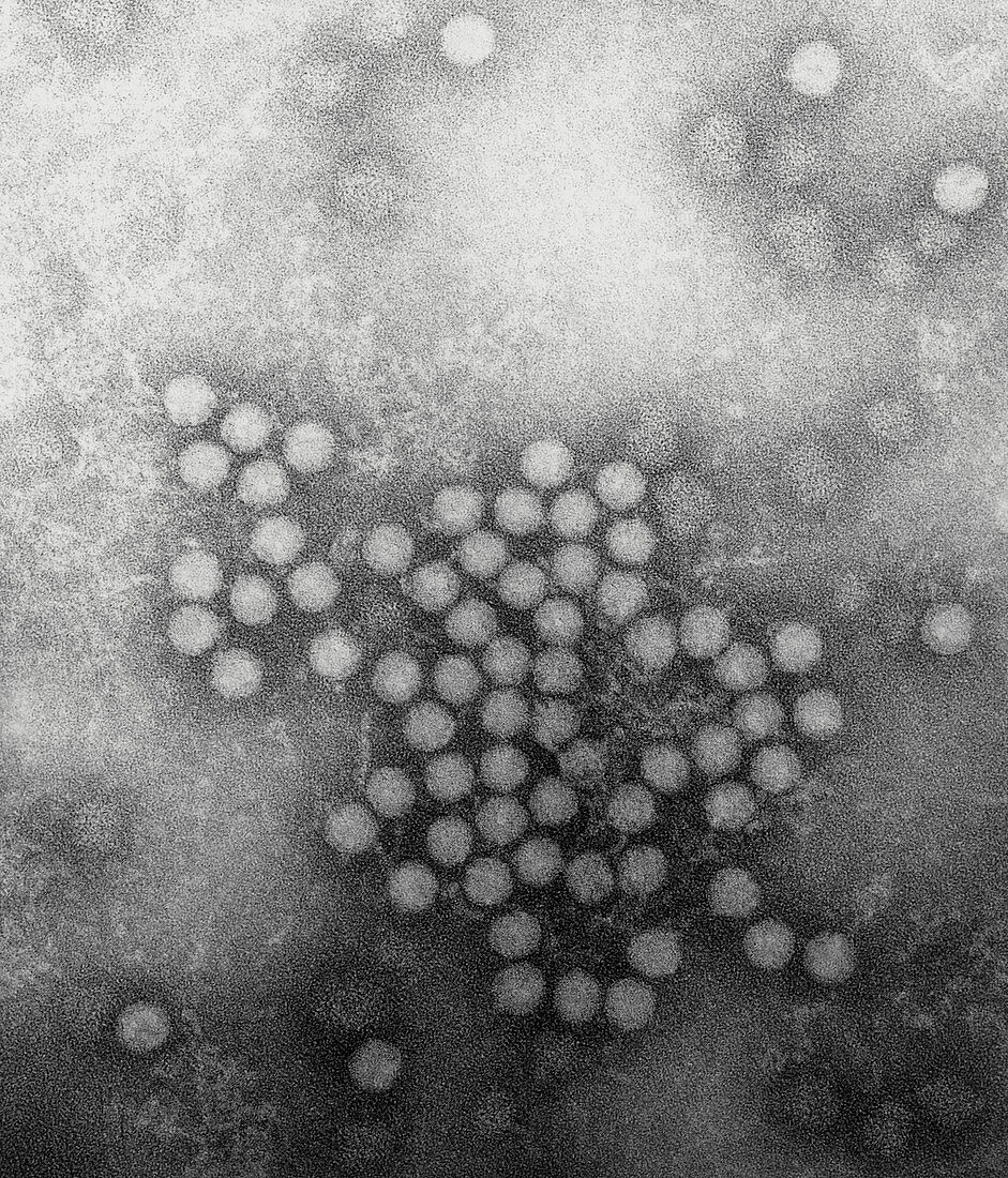 TEM of hepatitis A virus particles