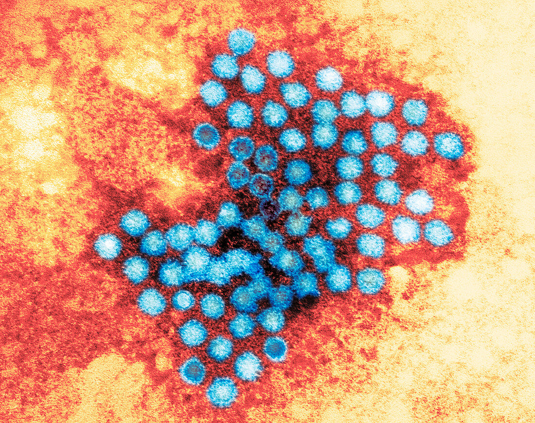 Hepatitis A virus particles,TEM