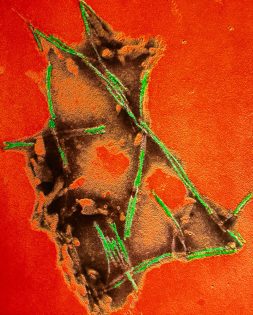 Coloured TEM of brain fibrils in mad cow disease