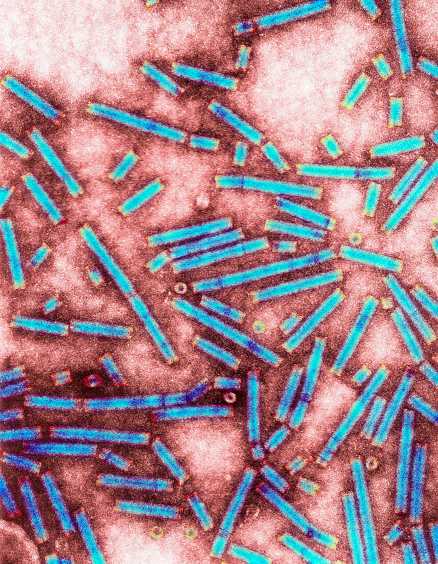 Barley stripe mosaic virus,TEM
