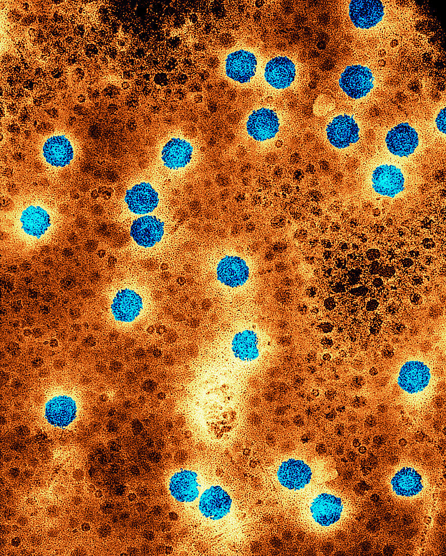 Cauliflower mosaic virus,TEM