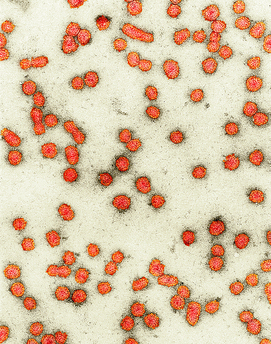 Prunus necrotic ringspot virus,TEM