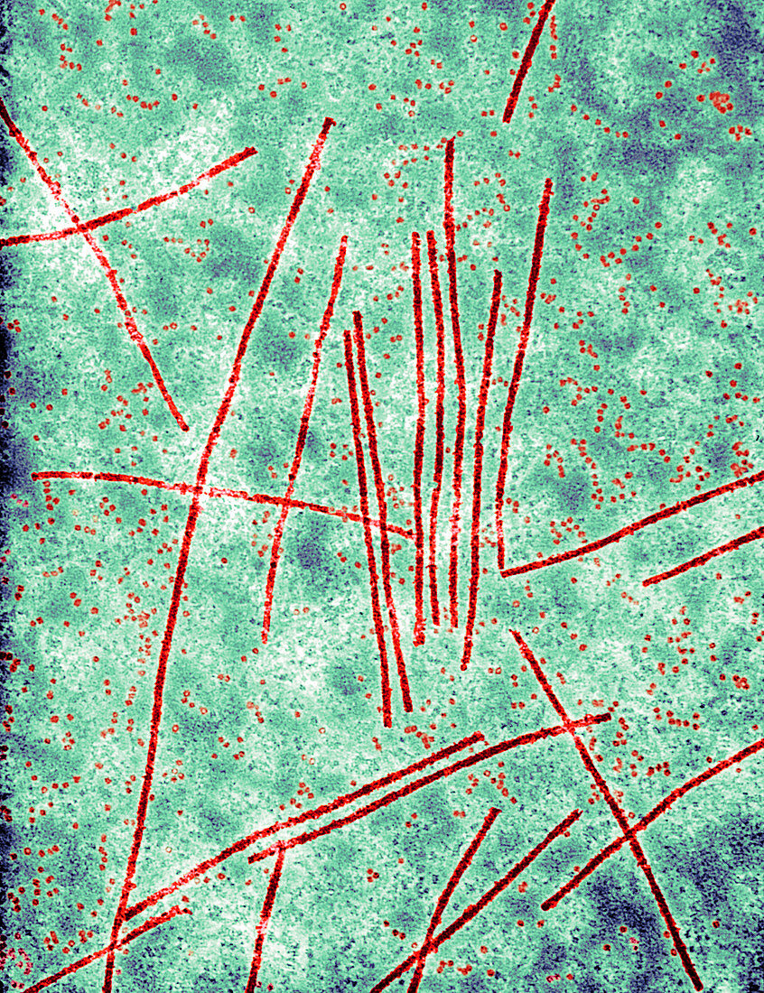 Red clover vein mosaic virus,TEM