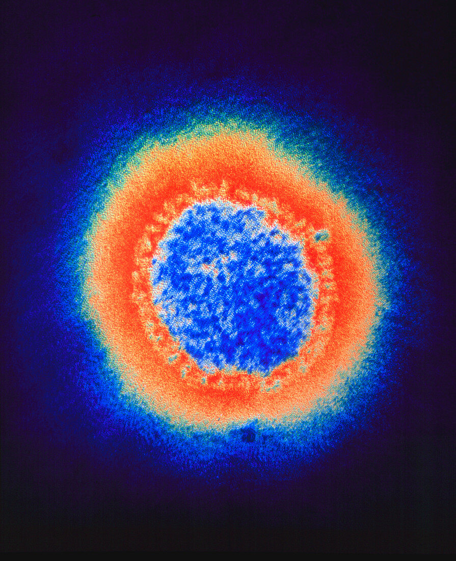 Coloured TEM of a single Beijing influenza virus