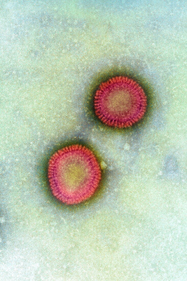 Influenza virus,TEM