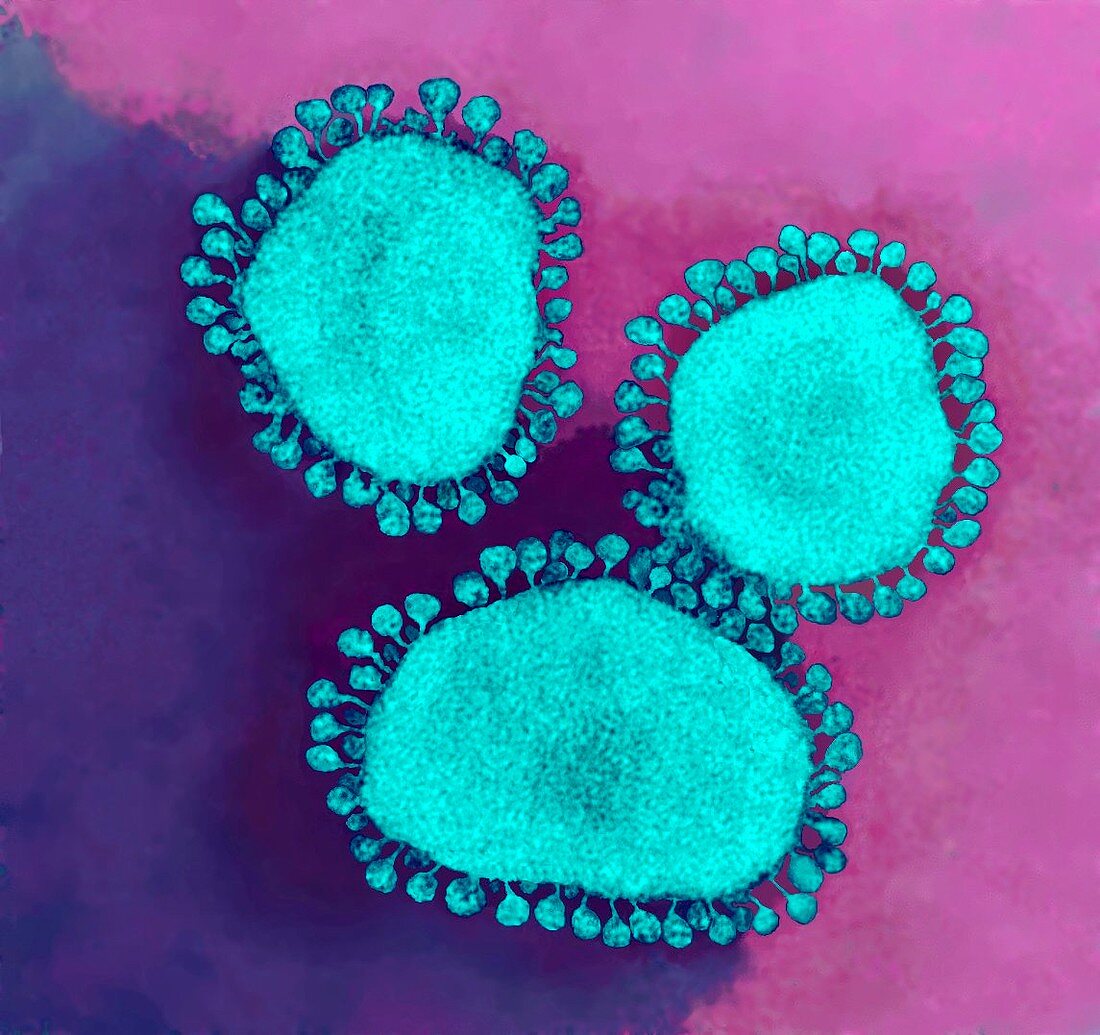 Coronavirus particles,TEM