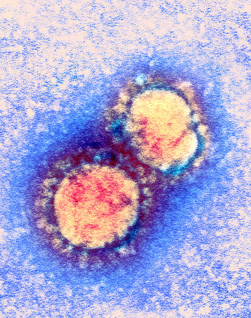 SARS virus particles,TEM