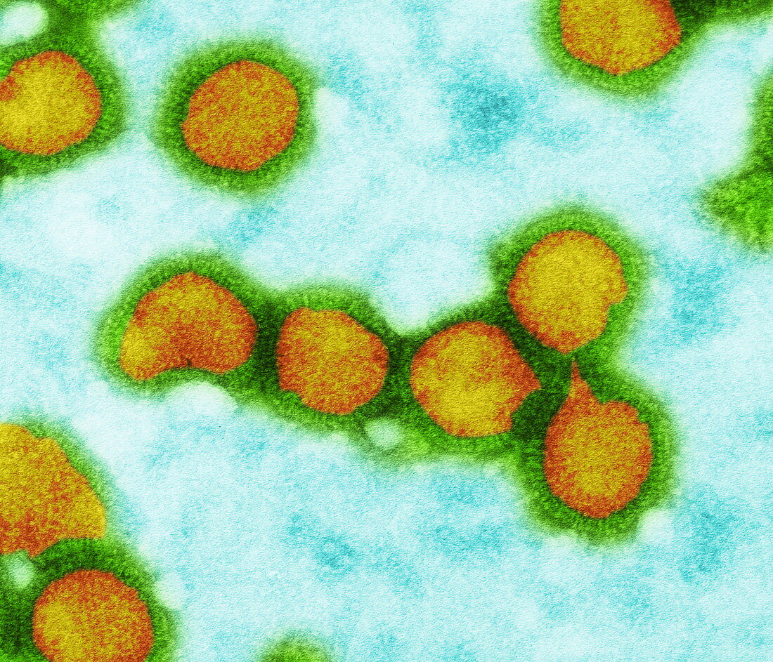 Influenza viruses,TEM