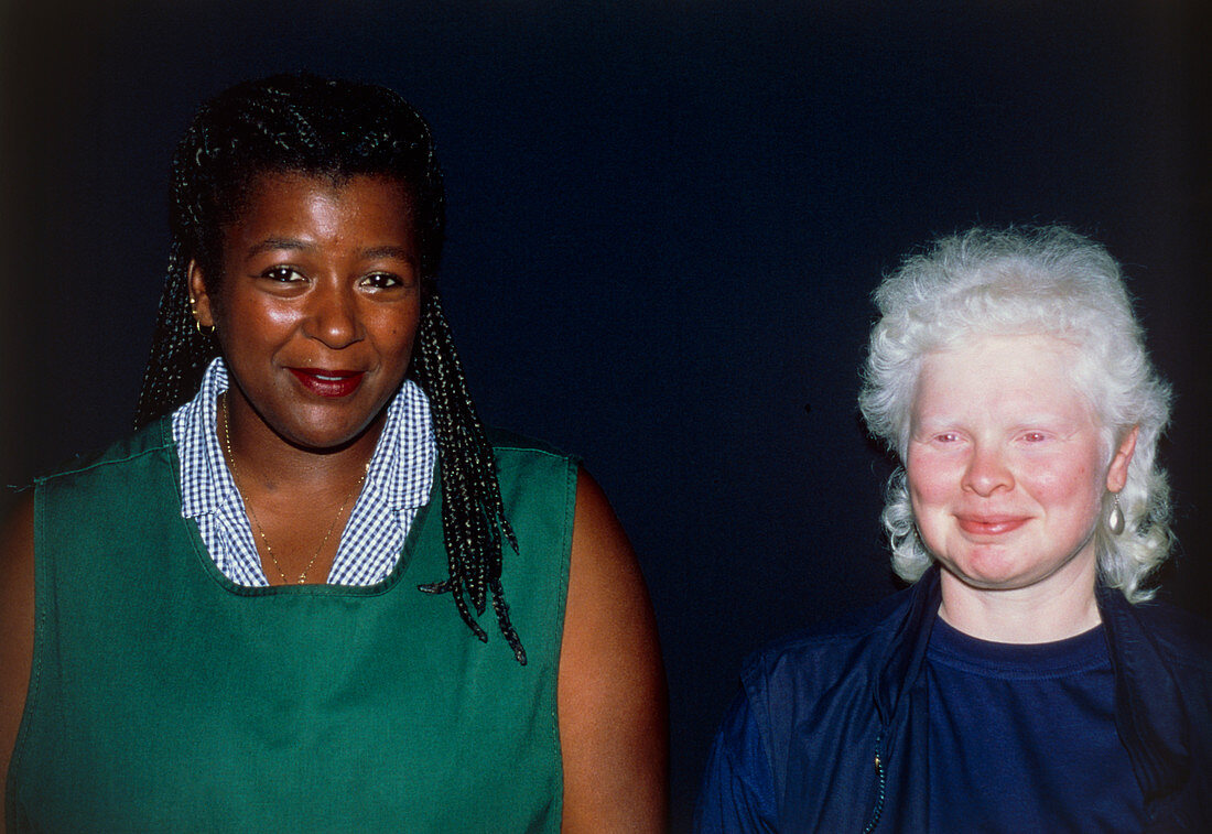 Albino woman next to a black woman