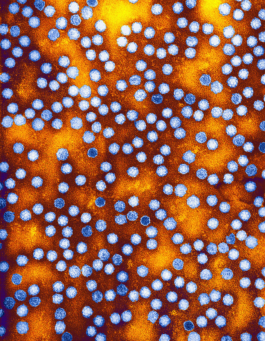 Turnip yellow mosaic virus,TEM