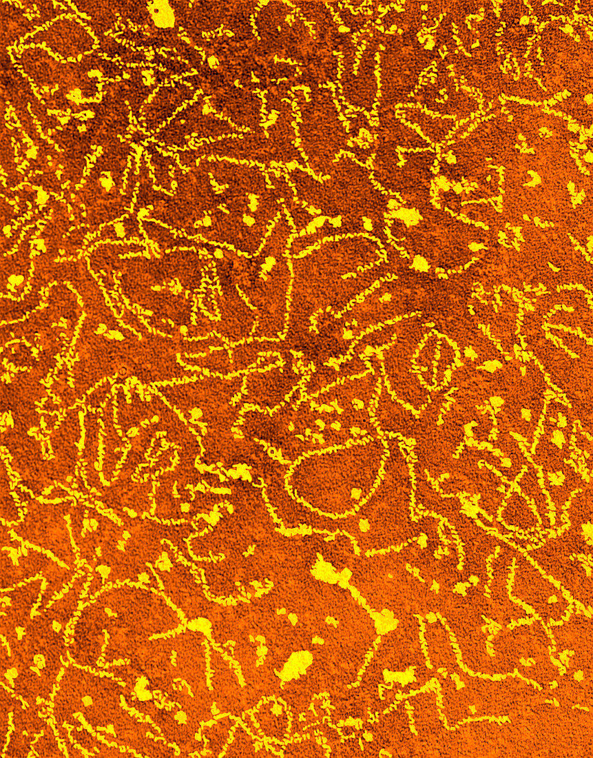 Maize yellow stripe virus,TEM