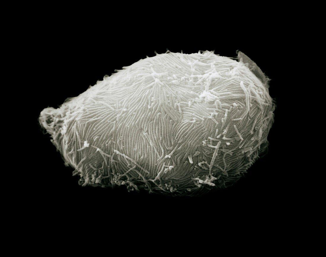 SEM of mutant blood cell surface infected with HIV