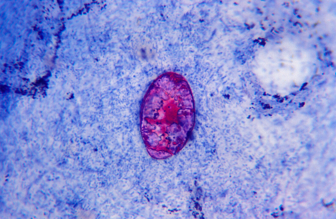 Cryptosporidium in AIDS,light micrograph