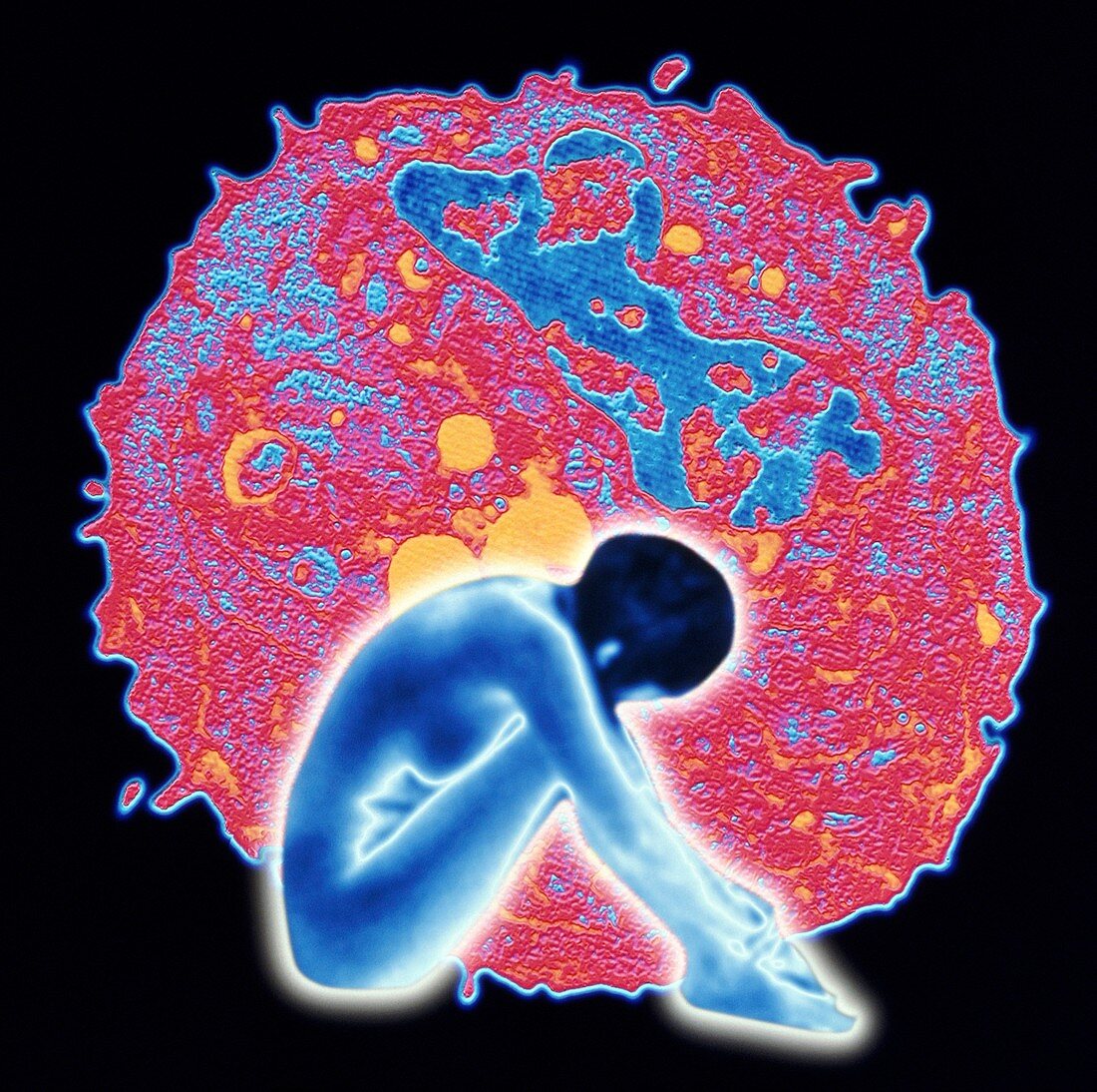 Computer artwork of woman and breast cancer cell