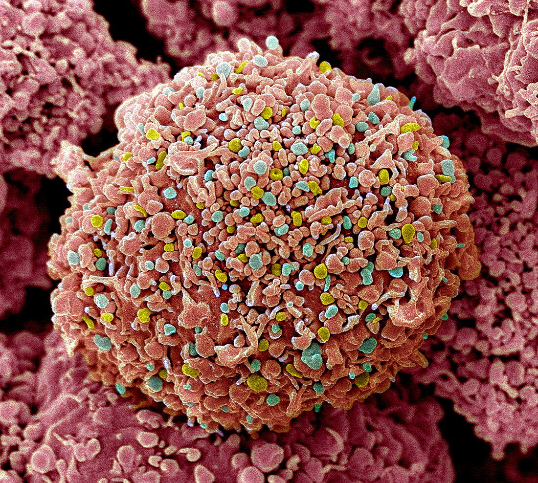 Breast cancer cell,SEM