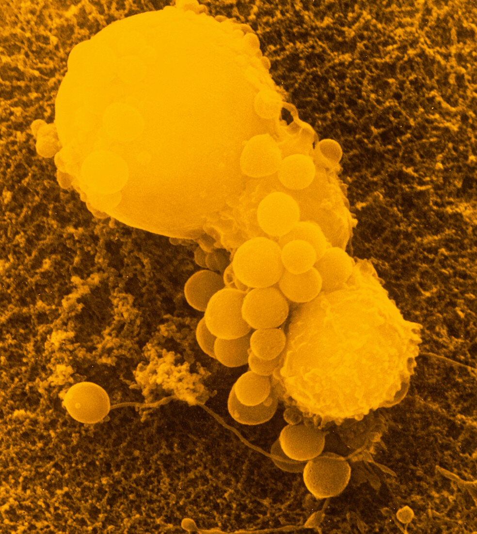 SEM of 2 T-lymphocite cells attacking cancer cell