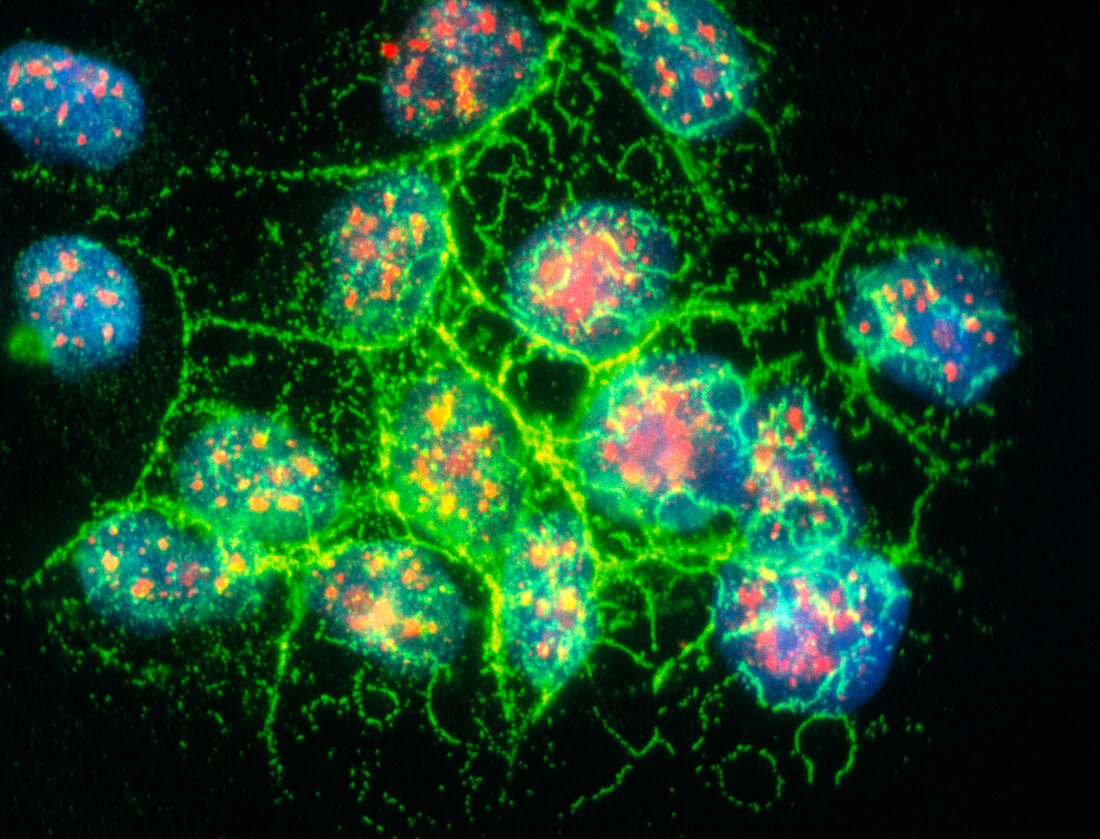 Immunofluorescent LM of lung cancer cell culture
