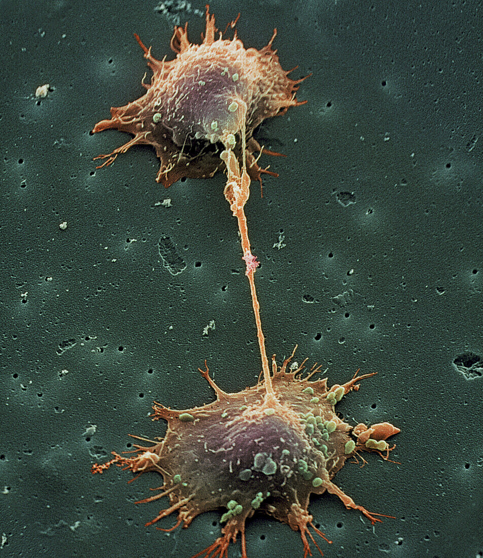 SEM of prostate cancer cell division