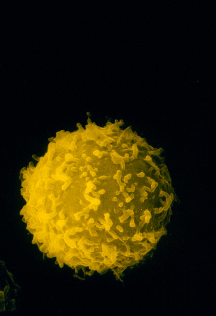 SEM of white blood cell (leukocyte)