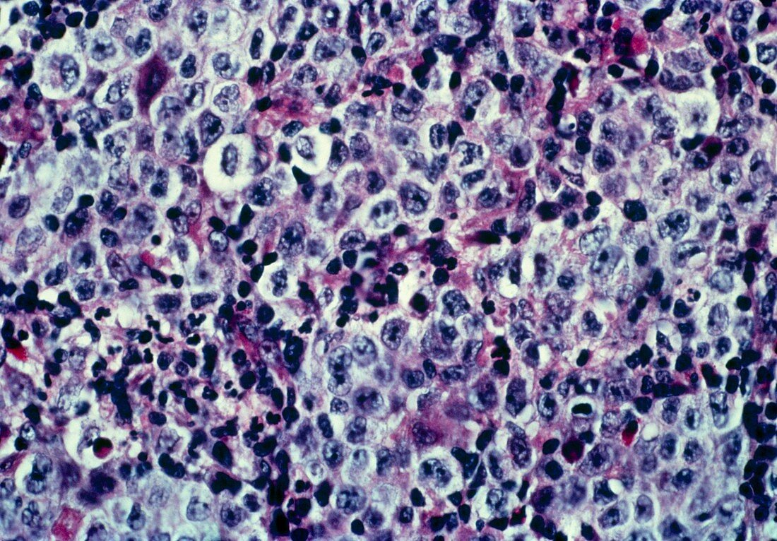 LM showing cells of human lymph node