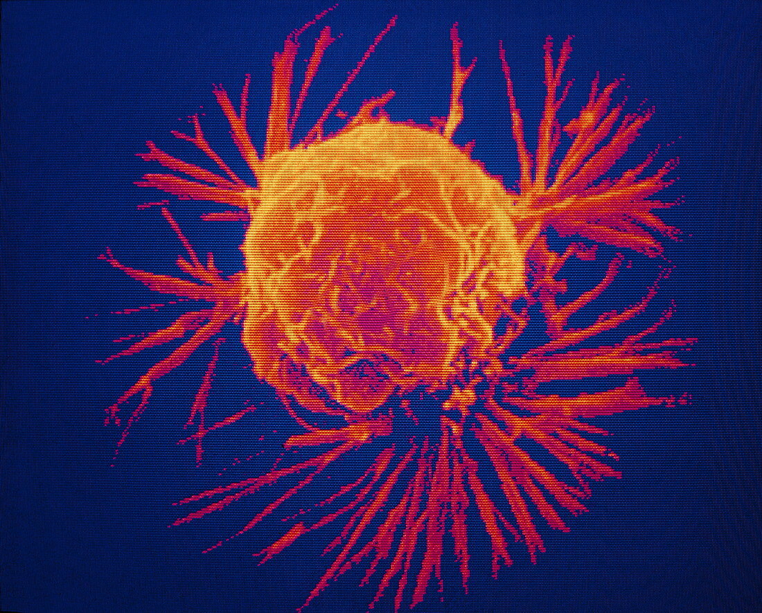 False-col SEM of single cancer cell