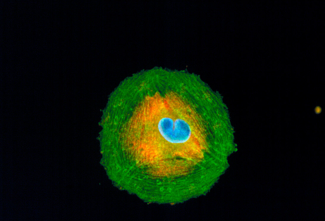 Immunofluorescent LM of a melanoma cancer cell