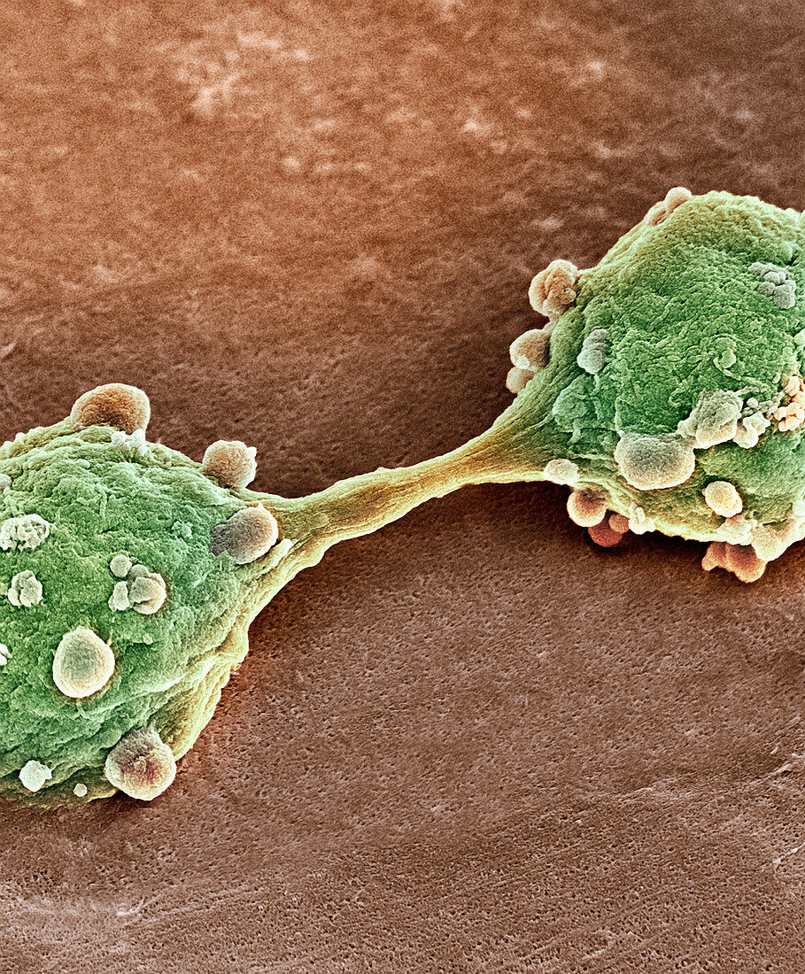 Bladder cancer cells dividing,SEM