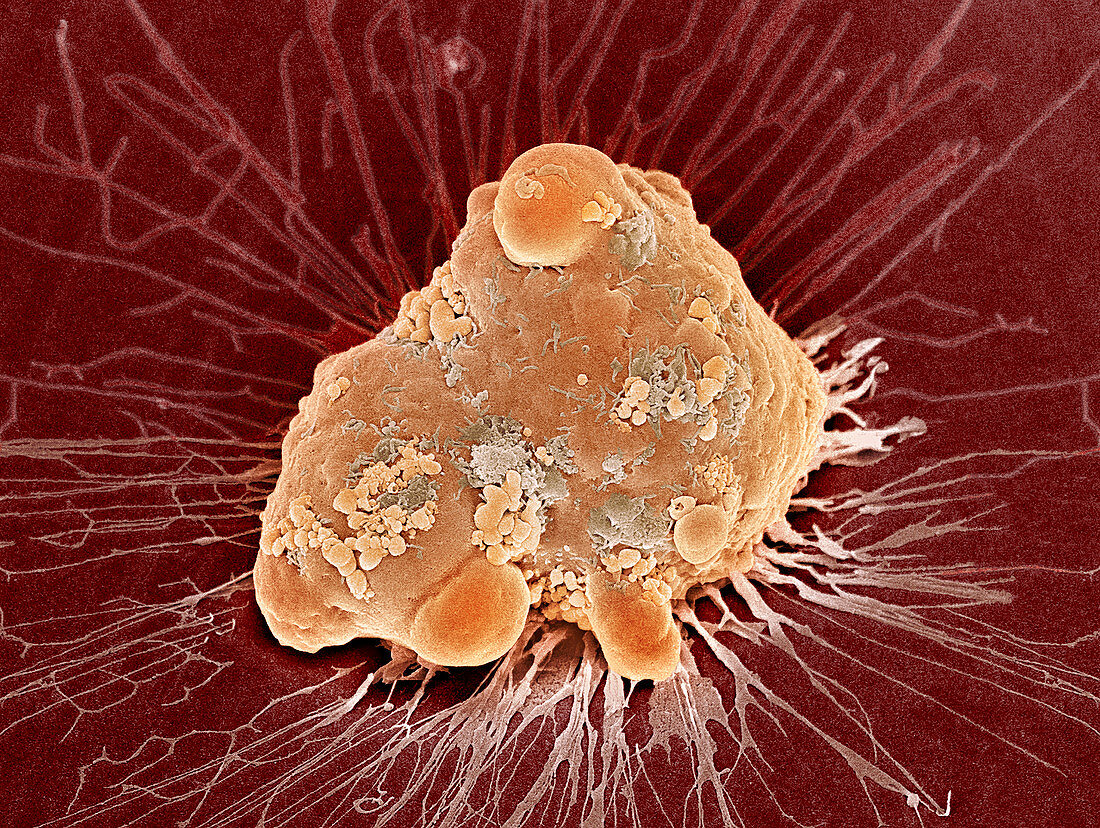 Cancer cell apoptosis,SEM