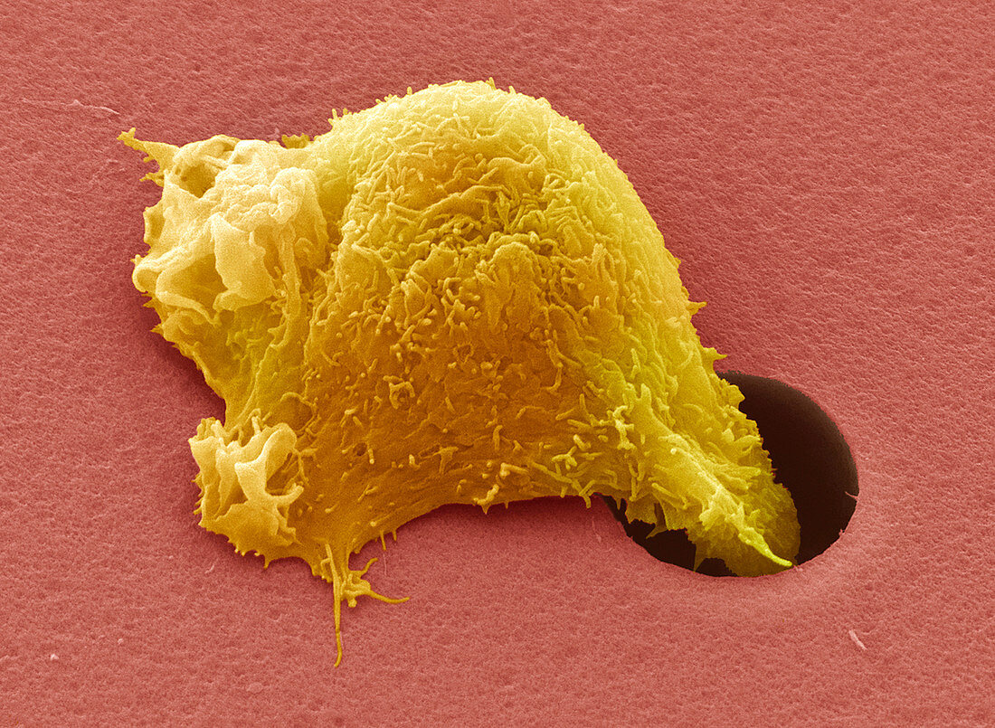 Sarcoma cells,SEM