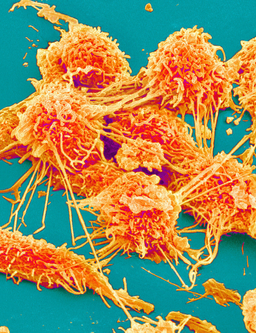 Colon cancer cells,SEM
