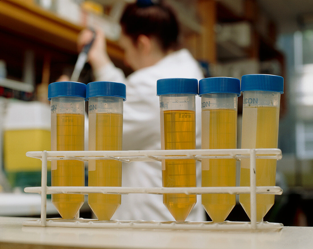 Faecal samples for bowel cancer DNA screening