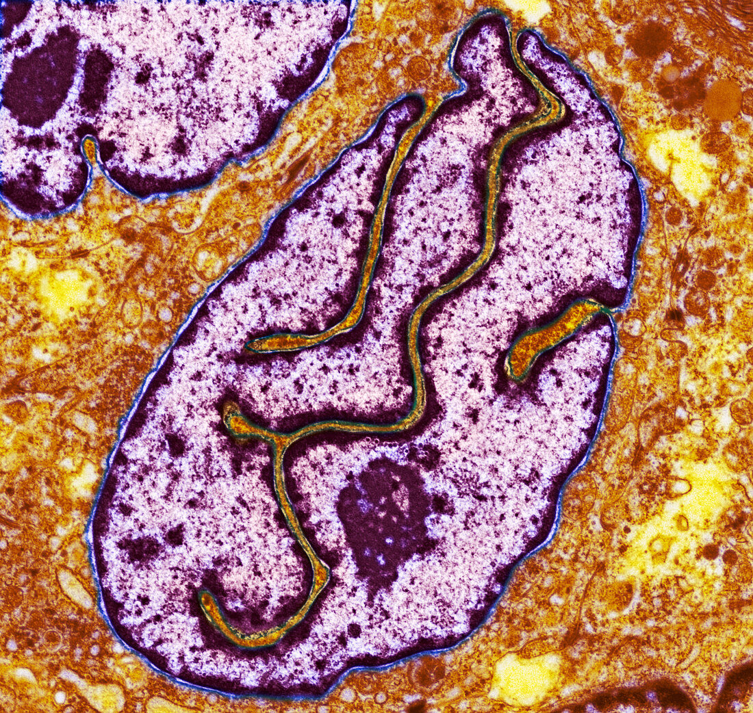 Liver cancer cell nucleus,TEM