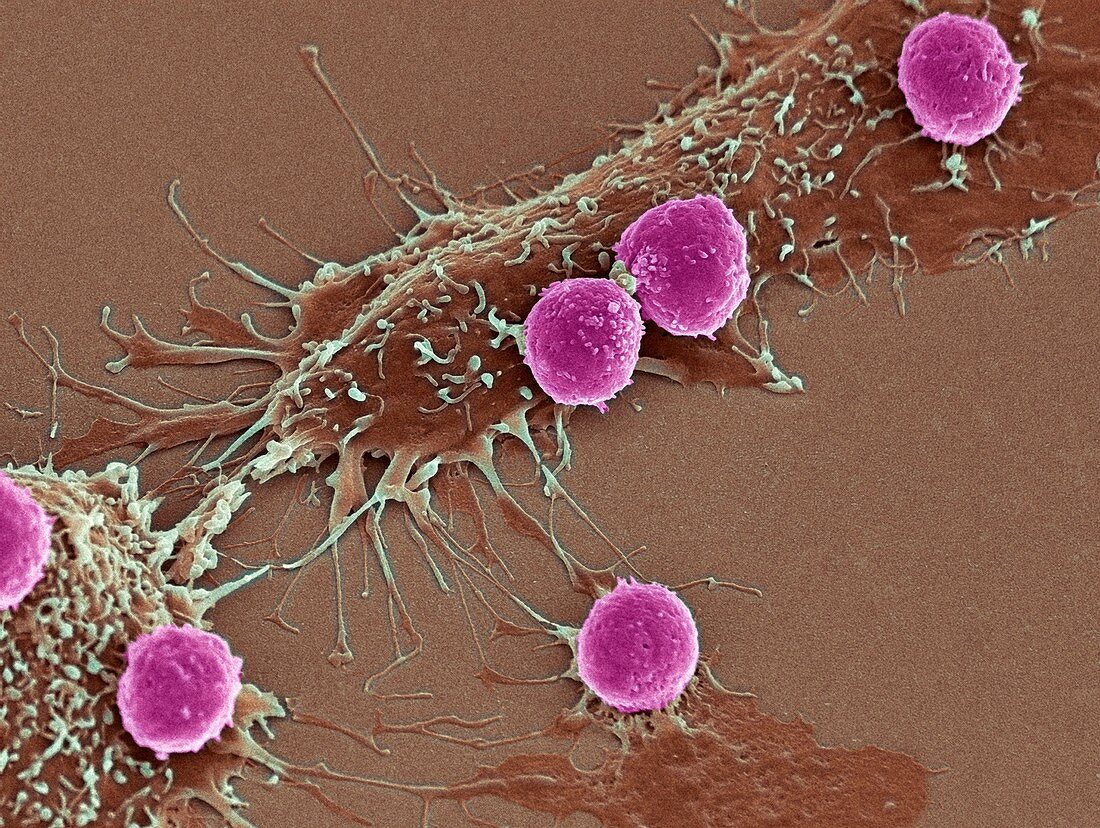 T lymphocytes and cancer cells,SEM