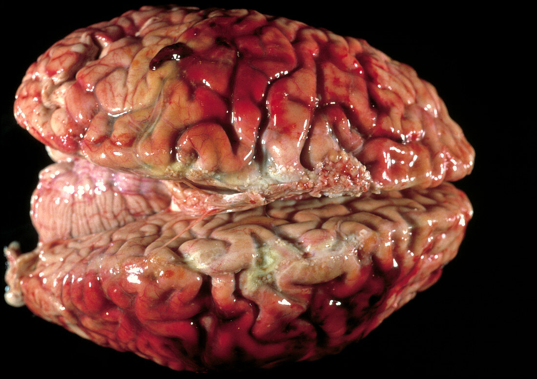 Bloody brain membranes