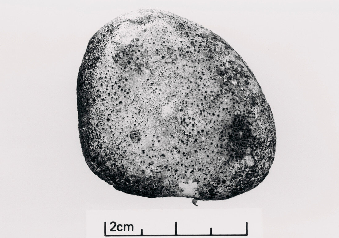 Specimen of a large gallstone