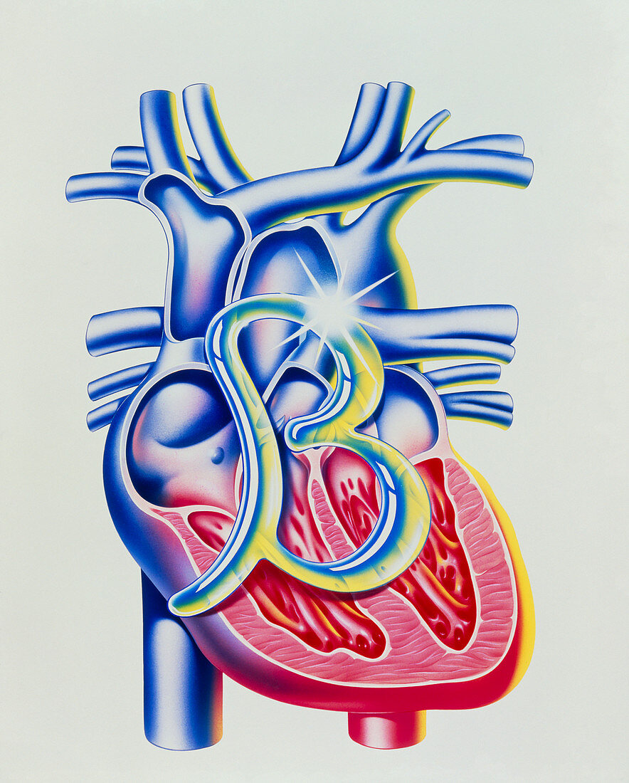 Heart disease: art of heart & beta blocker symbol