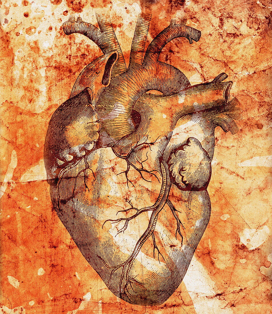 Unhealthy heart
